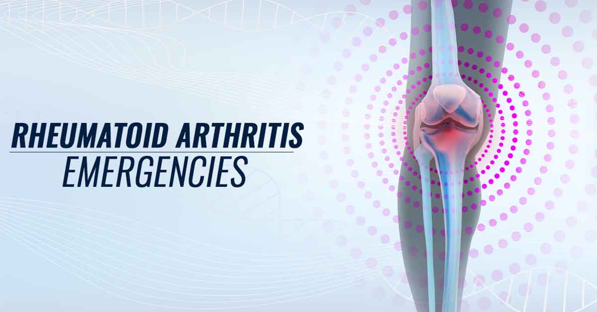 Rheumatoid Arthritis