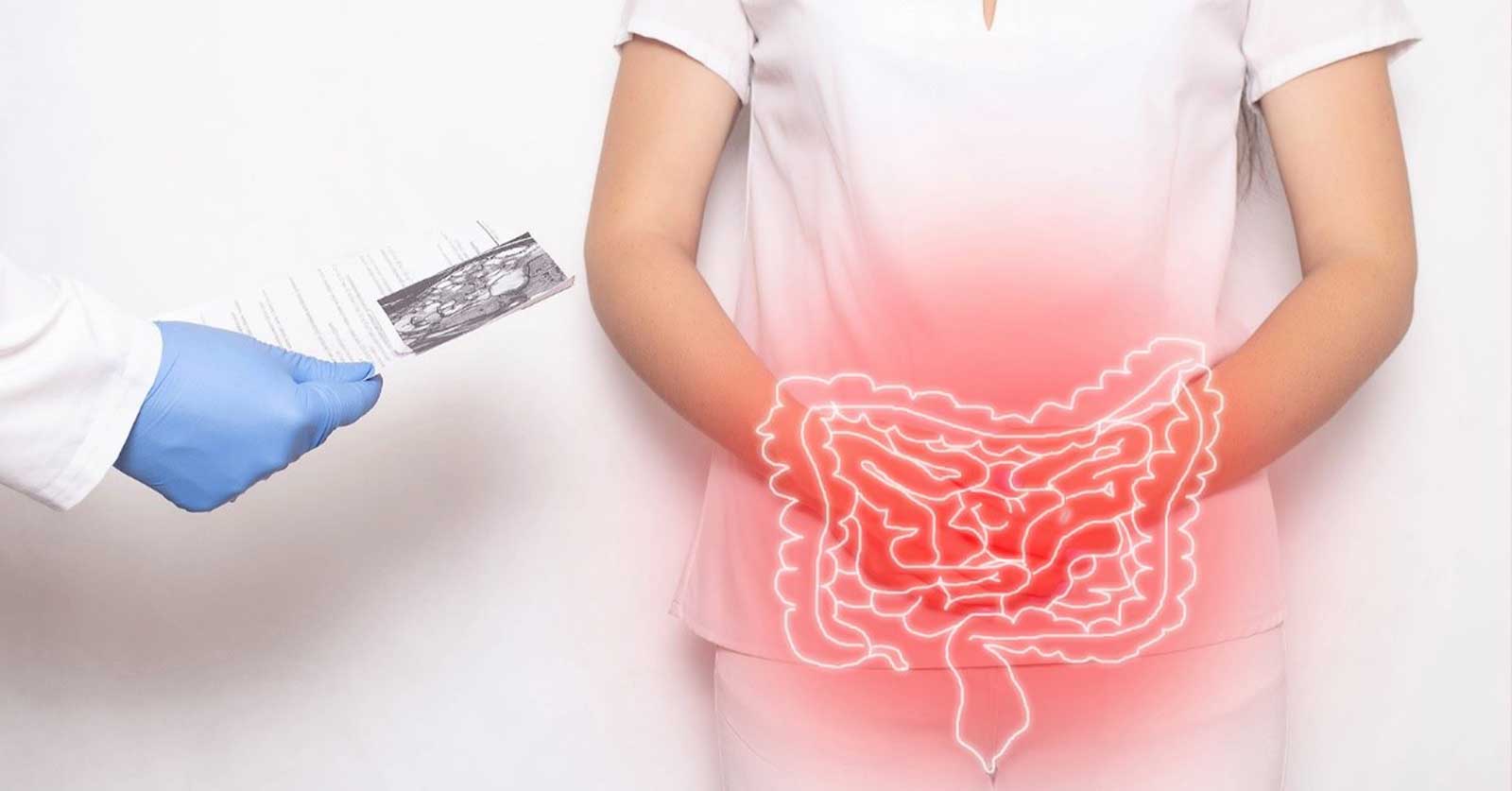 What to Know About Colonoscopies