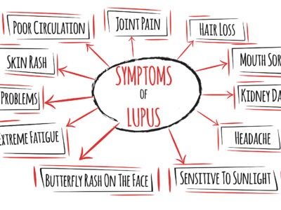 Signs and Symptoms of Lupus