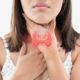 What is Thyroid Disease?