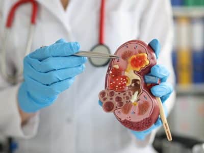 Kidney Disease Risk Factors