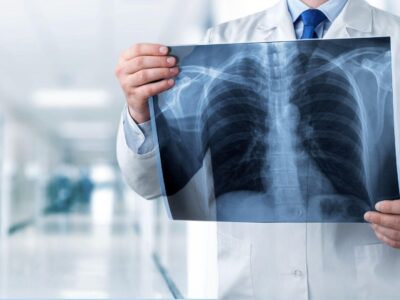 What You Should Know About Foreign Body Removal