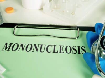 Mononucleosis: A Comprehensive Guide for Teens and Young Adults